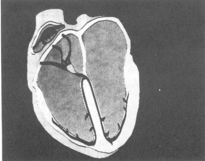 Figure 4a:  Using the GRID operation: like skeleton; 
half-a-dozen grid drawings can be used to define key positions for the 
distortion of a single design drawing, such as this drawing of the 
human heart. 


